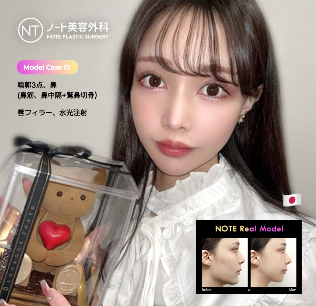 노트성형외과 전후사진 여자 모델 배너3